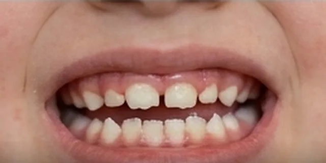 Children's Tooth Problems: illustration